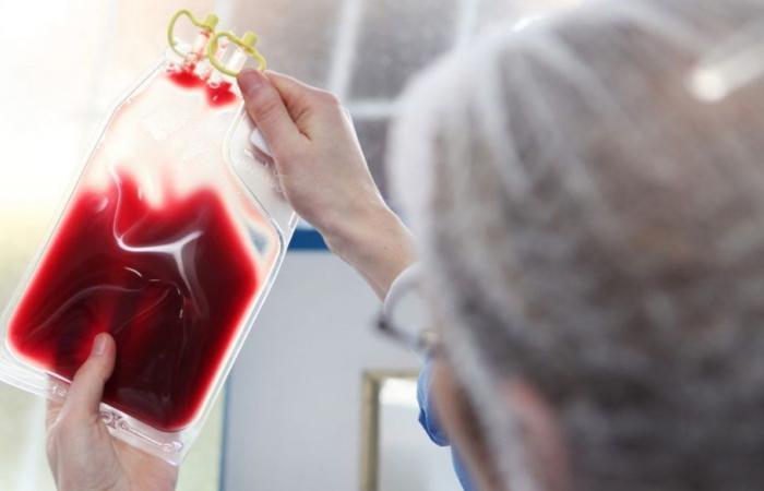 Un maggiore utilizzo delle trasfusioni di sangue potrebbe migliorare il recupero dopo gravi lesioni cerebrali traumatiche