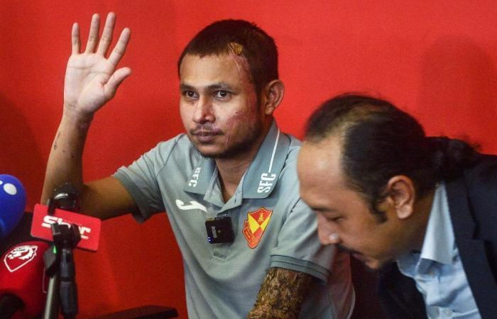 “Il medico ha detto che potrebbero volerci fino a sei mesi”, il calciatore malese cosparso di acido spera di tornare a giocare presto