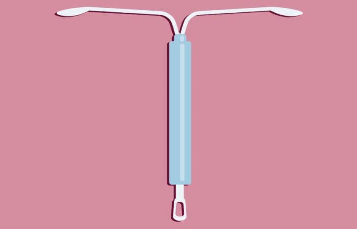 Costoso e doloroso, lo IUD rimane essenziale