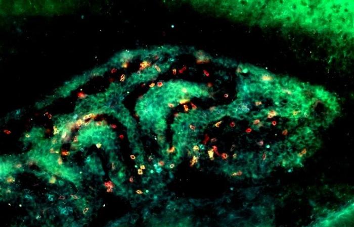 Toxoplasmosi: identificazione di un meccanismo che garantisce la sorveglianza immunitaria delle infezioni nel cervello