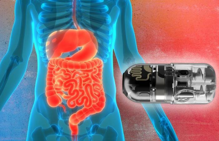 PillBot: tutto quello che devi sapere su questa magica pillola robotica che potrebbe rivoluzionare la tua salute