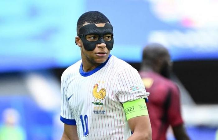 Kylian Mbappé mascherato “qualche settimana o addirittura qualche mese”