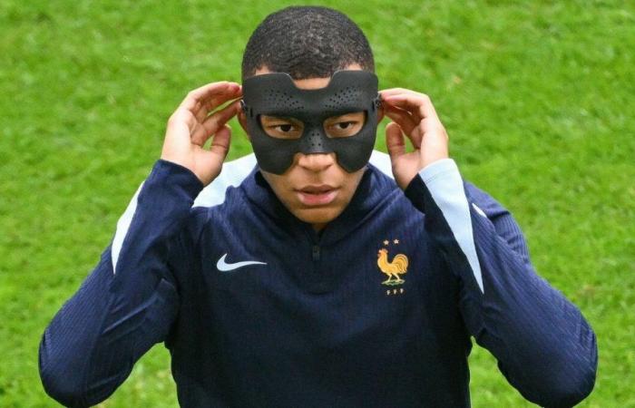 Francia-Belgio: immagini della nuova maschera di Kylian Mbappé, con rotella di regolazione