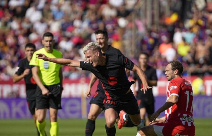 Orecchini
      Hamstring
      di
      Dani
      Olmo