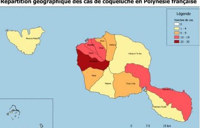 16 nuovi casi di pertosse questa settimana