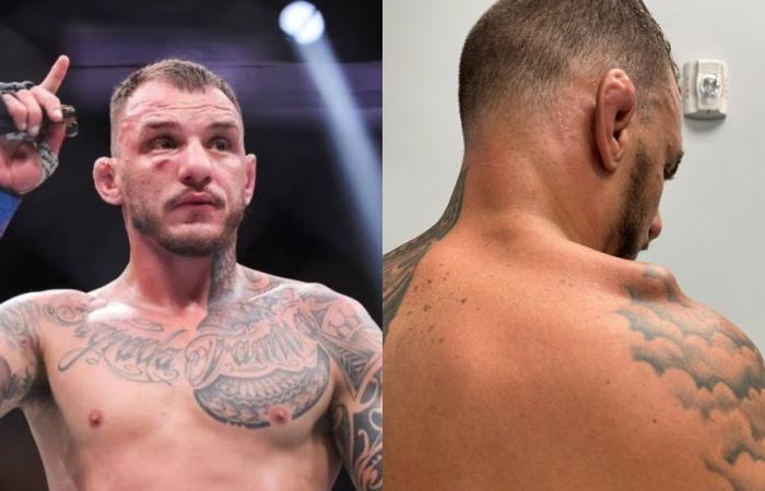 UFC Paris – Renato Moicano, gravemente ferito prima di affrontare BSD