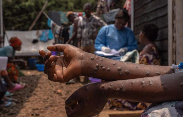 866 morti dall’inizio dell’anno, secondo l’agenzia sanitaria Africa CDC