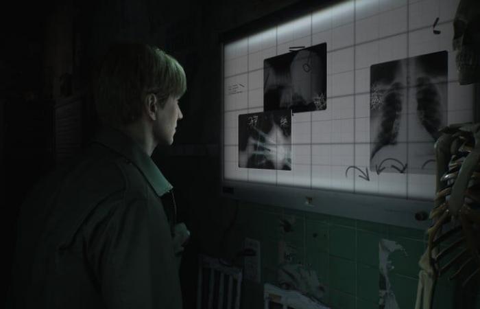 Silent Hill 2: dopo Resident Evil 4 e FFVII, questo remake è un nuovo must-have