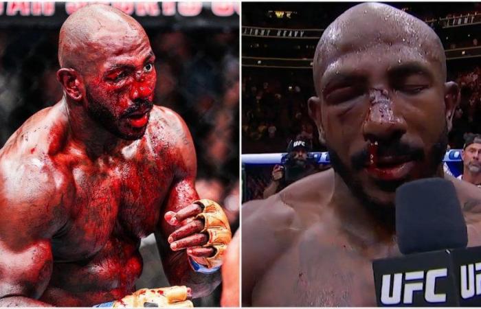 Il naso di Khalil Rountree non smetteva di sgorgare sangue nell’intervista a Savage post-UFC 307