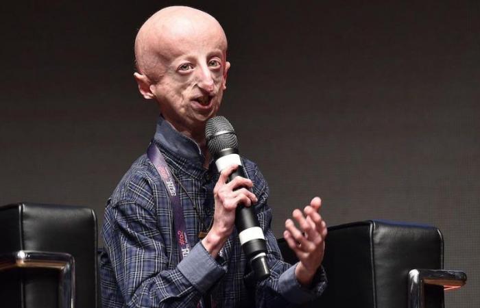 Che cos’è la progeria – Il Post