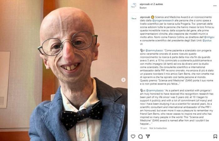 Sammy Basso: affetto da una malattia con una aspettativa di vita di 13 anni, è morto infine a 28 anni