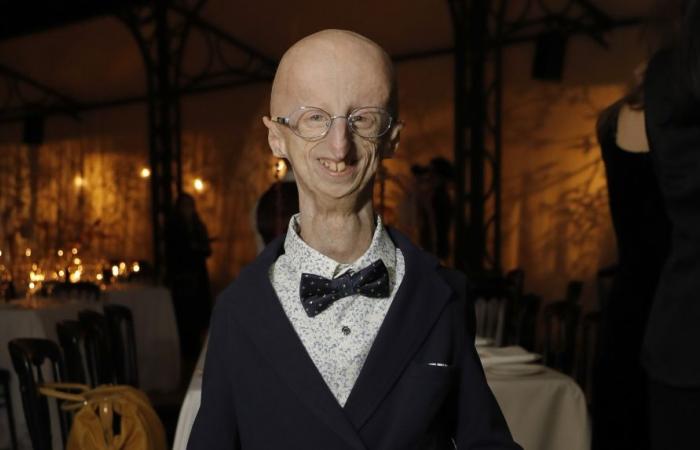 Sammy Basso, sopravvissuto alla progeria, muore a 28 anni