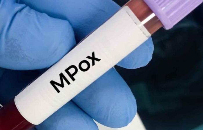 Un nuovo kit diagnostico Mpox pronto per essere commercializzato in Marocco