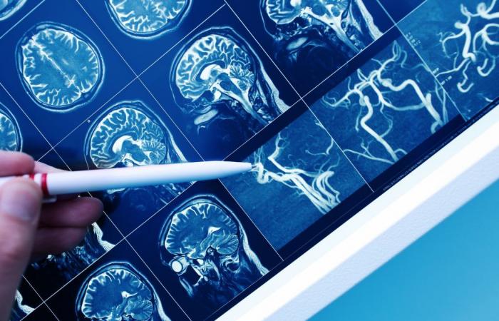 SALUTE VASCOLARE DEL CERVELLO: una chiave per il declino cognitivo legato all’età