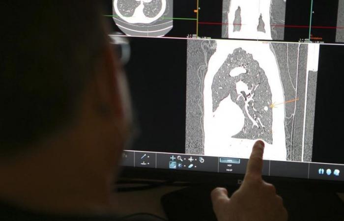 in Gironda, gli pneumologi sono allarmati dalla mancanza di professionisti