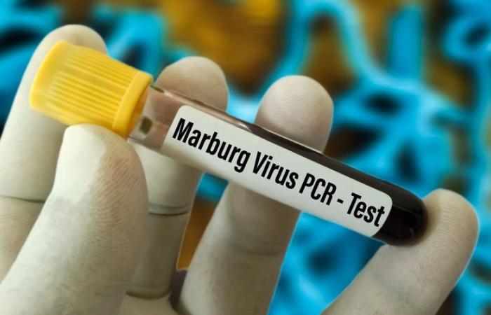 Una mortalità dell’88%: cos’è il virus Marburg, questa pericolosissima febbre emorragica che imperversa attualmente in Ruanda?