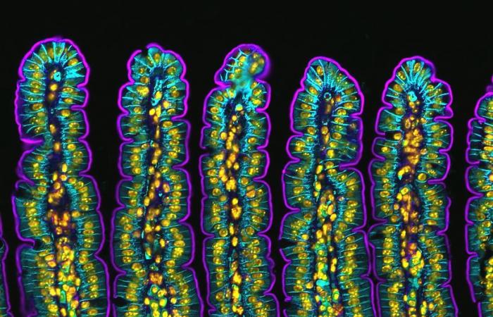 10 foto mozzafiato dal mondo microscopico