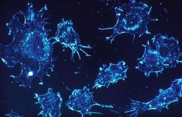 Scoperta nella ricerca sul cancro all'Università di Tel Aviv