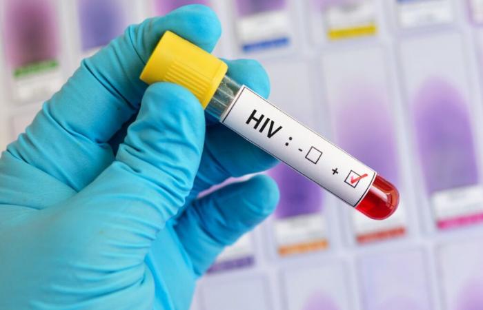 Test e diagnosi HIV: Toronto ancora in testa