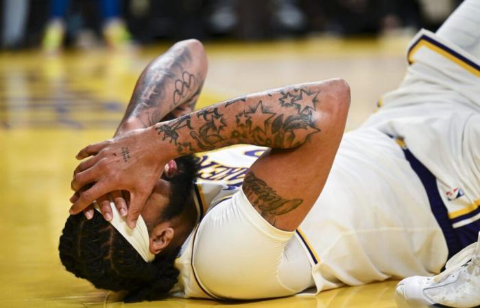 Il contendente MVP dei Lakers dovrà essere sottoposto a esame oculistico, secondo fonte ESPN