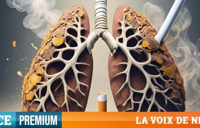 mobilitarsi per la diagnosi precoce del cancro al polmone