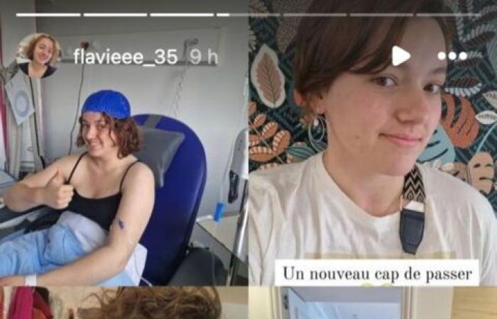 L'amore è nel prato: Flavie vittima di una forte caduta di capelli a causa delle cure contro il cancro, svela le foto