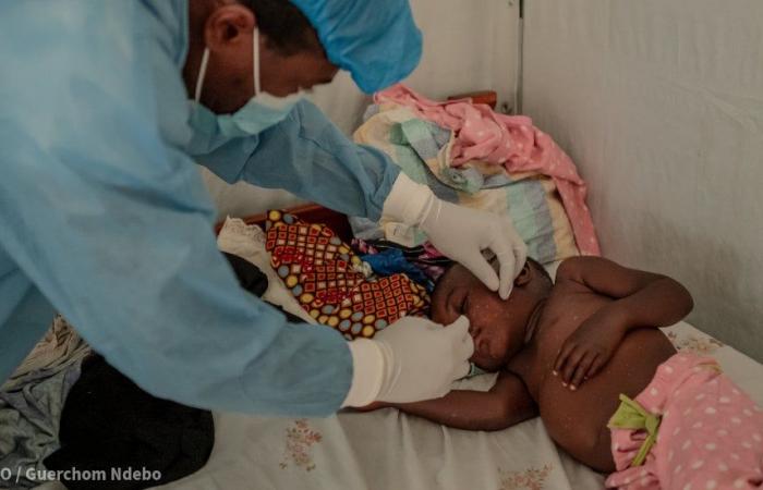 L’Africa può diventare leader nella produzione del vaccino anti-Mpox