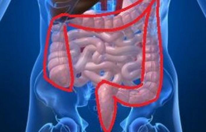 perché il cancro al colon colpisce pazienti sempre più giovani?