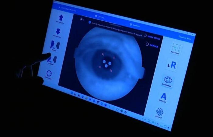 Nella provincia del Lussemburgo, rileviamo la retinopatia diabetica utilizzando l’IA!