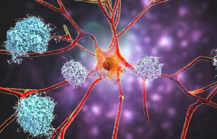 Alzheimer: via libera dall’Agenzia europea per i medicinali alla prima cura che rallenta la malattia: “un segnale incoraggiante”