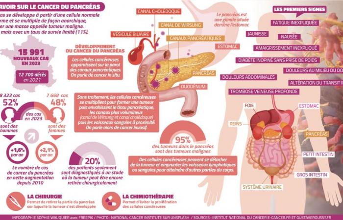 Esplosione nelle cifre del cancro al pancreas: “C’è sempre speranza” per Fabienne Portales, oncologa dell’ICM-Val d’Aurelle