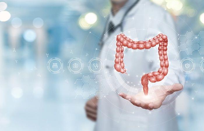 Predire il rischio di cancro nelle IBD: un nuovo modello