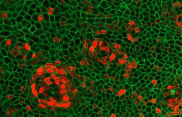 Nuove prospettive terapeutiche per le malattie infiammatorie croniche intestinali