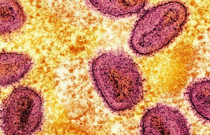 l’Organizzazione Mondiale della Sanità mantiene il massimo livello di allerta