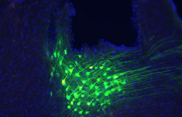 i ricercatori identificano un circuito cerebrale che collega la respirazione e il calmamento emotivo