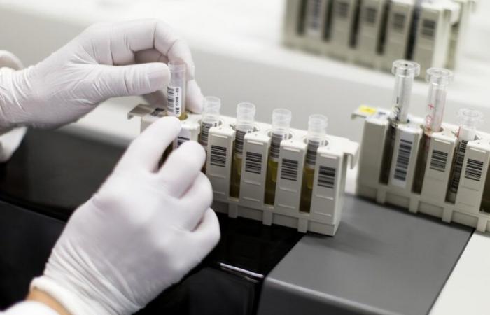 In Svizzera ogni giorno viene diagnosticata un’infezione da HIV