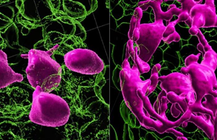 L’ingrigimento dei capelli può essere reversibile, suggerisce lo studio