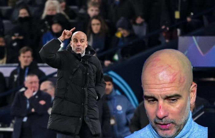 Cranio graffiato, Guardiola voleva “farsi male” dopo la rimonta del Feyenoord