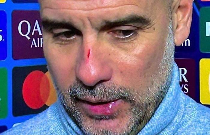 “Volevo farmi del male”: quando Pep Guardiola ammette di essersi grattato la faccia dopo l'incredibile pareggio al Manchester City