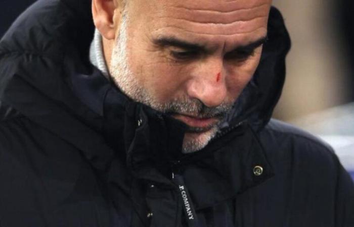 Guardiola qualifica le sue dichiarazioni a causa dei graffi sul viso