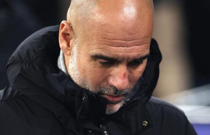 Pep Guardiola spiega le sue ferite al viso