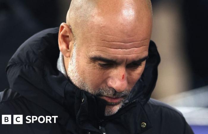 Pep Guardiola: l'allenatore del Manchester City chiarisce il commento “farmi del male” dopo la sconfitta del Feyenoord