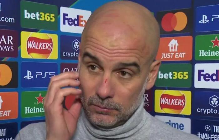 Dopo essersi fatto male… Guardiola è frustrato dopo la partita con il Feyenoord?