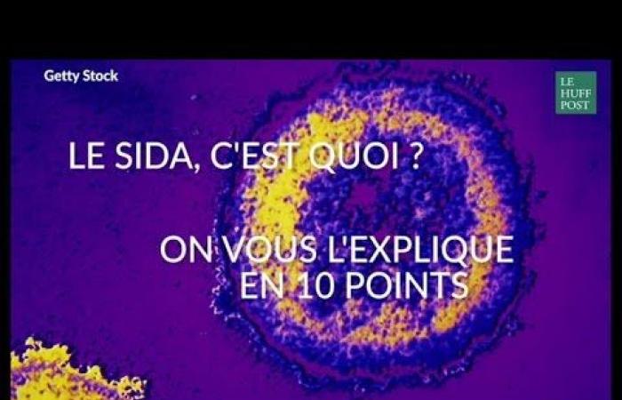 Quando l’intelligenza artificiale troverà il vaccino contro l’AIDS? ChatGPT ha risposto