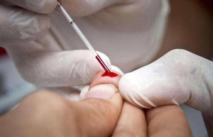 Come la Francia potrebbe porre fine all’AIDS