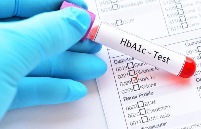 DIABETE: il controllo della glicemia significa un minore declino cognitivo