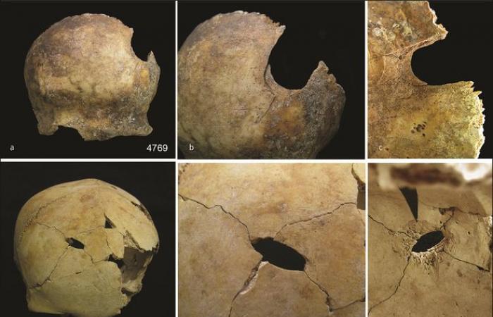 Si dice che un episodio di cannibalismo di massa abbia avuto luogo 4.000 anni fa in Inghilterra