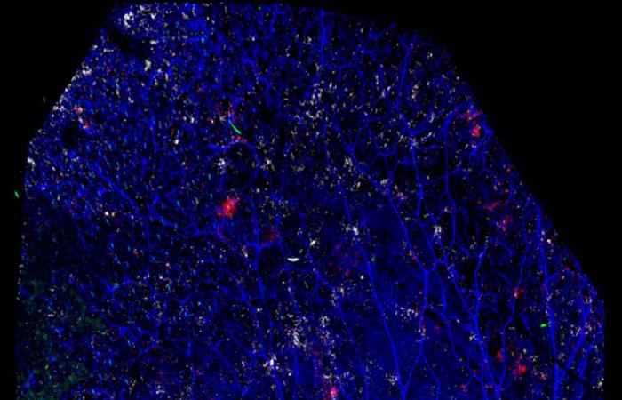 Immunità umorale della pelle, modellata dal microbiota, e suo potenziale per lo sviluppo di approcci vaccinali innovativi