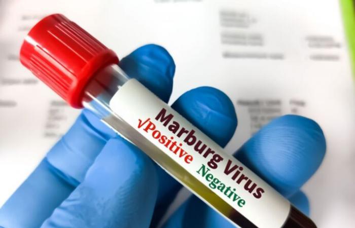 L’epidemia del virus Marburg in Ruanda è stata dichiarata conclusa