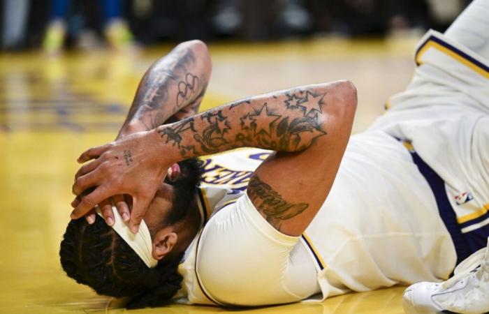 Cosa è successo ad Anthony Davis? La stella degli Hurt Lakers zoppica verso lo spogliatoio contro i Warriors il giorno di Natale